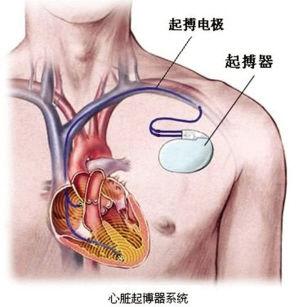 64ccb1e868599b6a4be8c8264774bf64_96c00054c862abe29cb.jpg